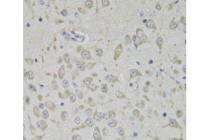 Immunohistochemistry of paraffin-embedded Mouse brain using RPL3 Polyclonal Antibody at dilution of 1:100 (40x lens). (RPL3 antibody)