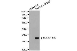 Western blot analysis of extracts from HeLa cells using Phospho-BCL2L1-S62 antibody (ABIN2987905). (BCL2L1 antibody  (pSer62))