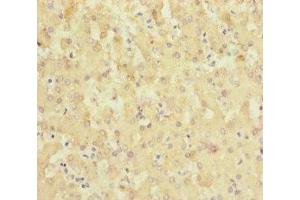Immunohistochemistry of paraffin-embedded human liver tissue using ABIN7169946 at dilution of 1:100