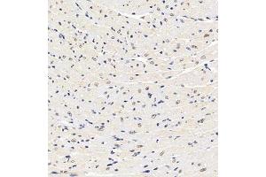 Immunohistochemistry of paraffin embedded mouse heart using HDAC (ABIN7074234) at dilution of 1:1200 (300x lens) (HDAC11 antibody)