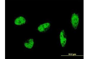Immunofluorescence of monoclonal antibody to SH2B1 on HeLa cell. (SH2B1 antibody  (AA 327-426))