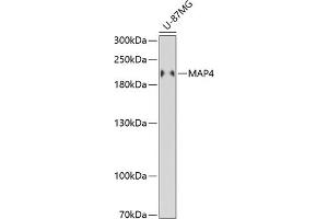 Western blot analysis of extracts of U-87MG cells, using M antibody (ABIN6130539, ABIN6143505, ABIN6143506 and ABIN6221614) at 1:3000 dilution.