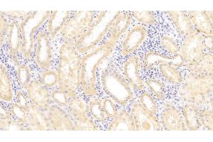Detection of MHCE in Human Kidney Tissue using Polyclonal Antibody to Major Histocompatibility Complex Class I E (MHCE) (HLA-E antibody  (AA 22-358))