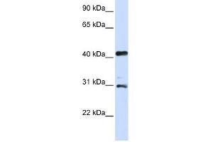 AURKA antibody used at 0. (Aurora A antibody  (C-Term))