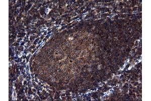 Image no. 6 for anti-NIMA (Never In Mitosis Gene A)-Related Kinase 11 (NEK11) antibody (ABIN1499682) (NEK11 antibody)