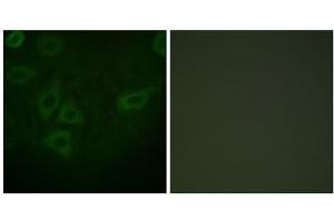 Immunofluorescence analysis of HepG2 cells, using TK (epitope around residue 13) antibody. (TK (N-Term), (Ser13) antibody)