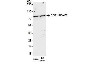 anti-Ring Finger and WD Repeat Domain 2, E3 Ubiquitin Protein Ligase (RFWD2) (AA 1-50) antibody