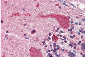 Human Brain, Cerebellum (formalin-fixed, paraffin-embedded) stained with Heat Shock Protein 90 (HSP90) antibody ABIN364328 at 5 ug/ml followed by biotinylated anti-mouse IgG secondary antibody ABIN481714, alkaline phosphatase-streptavidin and chromogen. (HSP90 antibody  (AA 1-732))