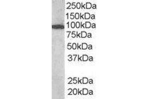 ABIN2560712 (1µg/ml) staining of human bone marrow lysate (35µg protein in RIPA buffer). (VAV3 antibody  (Internal Region))