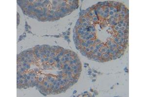 IHC-P analysis of Kidney tissue, with DAB staining. (KEL antibody  (AA 439-713))