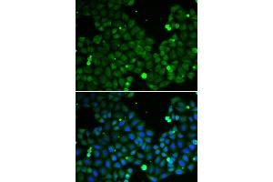 Immunofluorescence analysis of A549 cells using HIF1AN antibody (ABIN5973179). (HIF1AN antibody)