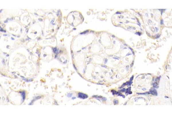 AKAP12 antibody  (AA 1485-1782)