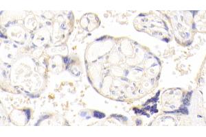 Detection of AKAP12 in Human Placenta Tissue using Polyclonal Antibody to A Kinase Anchor Protein 12 (AKAP12) (AKAP12 antibody  (AA 1485-1782))