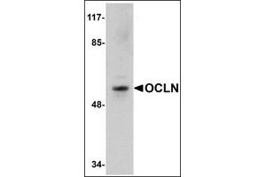 Western blot analysis of OCLN in human liver tissue lysate with this product at 1 μg/ml. (Occludin antibody  (C-Term))
