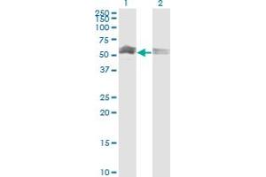 Western Blot analysis of CFLAR expression in transfected 293T cell line by CFLAR monoclonal antibody (M03), clone 1G1.