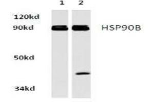 Image no. 2 for anti-Heat Shock Protein 90kDa alpha (Cytosolic), Class B Member 1 (HSP90AB1) antibody (ABIN265474) (HSP90AB1 antibody)