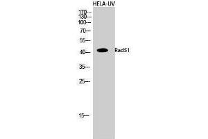 Western Blotting (WB) image for anti-DNA Repair Protein Homolog 1 (RAD51) (Thr555) antibody (ABIN3177106) (RAD51 antibody  (Thr555))
