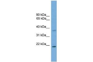 WB Suggested Anti-GSTM1  Antibody Titration: 0. (GSTM1 antibody  (C-Term))