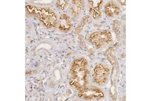Immunohistochemical staining of human kidney with STX7 polyclonal antibody  shows strong luminal membranous and cytoplasmic positivity in cells in tubules at 1:50-1:200 dilution. (Syntaxin 7 antibody)