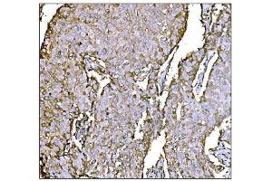 IHC analysis of HCCS using anti-HCCS antibody (ABIN7602424). (HCCS antibody  (AA 76-268))