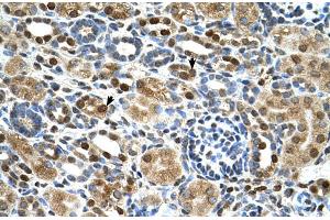 Human kidney (ZNF169 antibody  (Middle Region))