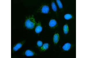 IF analysis of GHITM using anti-GHITM antibody (ABIN7599294). (GHITM antibody  (AA 1-345))