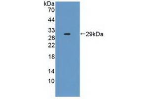 Western blot analysis of recombinant Human IL2Ra.