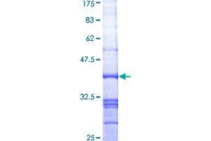 MIB2 Protein (AA 381-480) (GST tag)