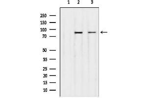 anti-Upstream Binding Transcription Factor, RNA Polymerase I (UBTF) (Internal Region) antibody