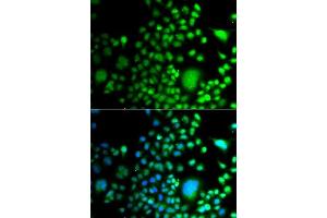 Immunofluorescence analysis of A549 cells using PAX6 antibody. (PAX6 antibody  (AA 1-300))