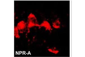 Image no. 1 for anti-Natriuretic Peptide Receptor A/guanylate Cyclase A (Atrionatriuretic Peptide Receptor A) (NPR1) (N-Term) antibody (ABIN360587) (NPR1 antibody  (N-Term))