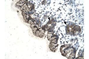PARP3 antibody was used for immunohistochemistry at a concentration of 4-8 ug/ml to stain Epithelial cells of fundic glands (arrows) in Human Stomach. (PARP3 antibody)