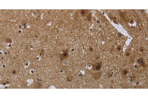 Immunohistochemistry of paraffin-embedded Human brain tissue using CD236 Polyclonal Antibody at dilution 1:60 (CD236/GYPC antibody)