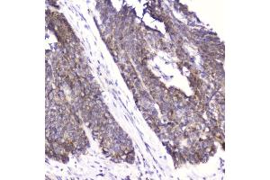 IHC analysis of Cardiac FABP using anti-Cardiac FABP antibody (ABIN5693024).