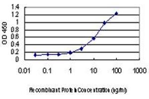 Detection limit for recombinant GST tagged TFAP2A is approximately 1ng/ml as a capture antibody. (TFAP2A antibody  (AA 99-205))