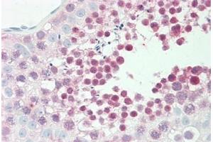Human Testis: Formalin-Fixed, Paraffin-Embedded (FFPE) (GLRX3 antibody  (AA 81-110))