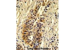 Immunohistochemistry (IHC) image for anti-Transaldolase 1 (TALDO1) antibody (ABIN3002744) (TALDO1 antibody)