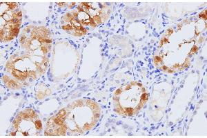 Immunohistochemistry of paraffin-embedded Rat kidney using Pck1 Polyclonal Antibody at dilution of 1:100 (PCK1 antibody)