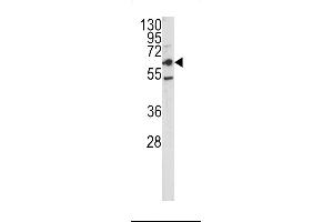 Western blot analysis of CEACAM antibody in HepG2 cell line lysates (35ug/lane) (CEACAM5 antibody  (N-Term))