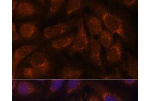 Immunofluorescence analysis of U-2 OS cells using CREB3 Polyclonal Antibody at dilution of 1:100. (CREB3 antibody)