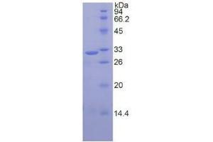 SDS-PAGE of Protein Standard from the Kit (Highly purified E. (CAPN1 ELISA Kit)