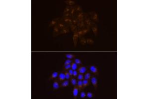 Immunofluorescence analysis of HeLa cells using USO1 Rabbit mAb (ABIN7271234) at dilution of 1:100 (40x lens). (USO1 antibody)