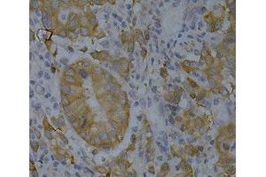 Immunohistochemistry (Paraffin-embedded Sections) (IHC (p)) image for anti-Bridging Integrator 1 (BIN1) antibody (ABIN7259755)