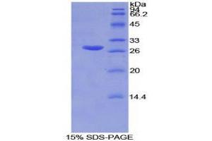 SDS-PAGE (SDS) image for Glutathione S-Transferase mu 2 (Muscle) (GSTM2) (AA 5-202) protein (His tag) (ABIN1877942) (GSTM2 Protein (AA 5-202) (His tag))