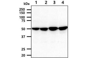 The cell lysates (40ug) were resolved by SDS-PAGE, transferred to PVDF membrane and probed with anti-human PDHX antibody (1:1000).