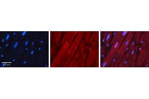 Rabbit Anti-NKX2-5 Antibody Catalog Number: ARP31575_P050 Formalin Fixed Paraffin Embedded Tissue: Human Heart Muscle Tissue Observed Staining: Nucleus Primary Antibody Concentration: 1:100 Other Working Concentrations: 1:600 Secondary Antibody: Donkey anti-Rabbit-Cy3 Secondary Antibody Concentration: 1:200 Magnification: 20X Exposure Time: 0.