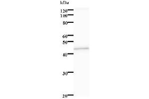 Western Blotting (WB) image for anti-serine/threonine Kinase 38 Like (STK38L) antibody (ABIN931250) (STK38L antibody)