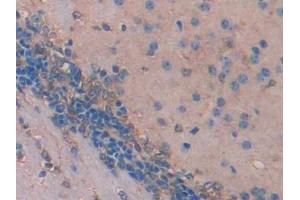 IHC-P analysis of Mouse Cerebrum Tissue, with DAB staining. (IDS antibody  (AA 180-448))