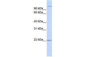 PDS5B antibody used at 1 ug/ml to detect target protein. (PDS5B antibody)