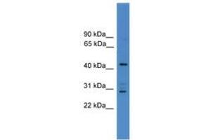 Image no. 1 for anti-Armadillo Repeat Containing 8 (ARMC8) (N-Term) antibody (ABIN6746434) (ARMC8 antibody  (N-Term))